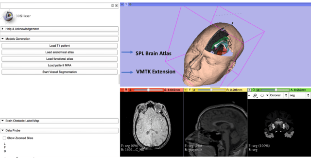 Integrating artificial intelligence in healthcare - which European countries are using it?