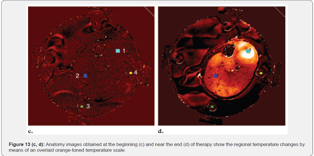 This Florida nonprofit wants AI to warn communities in real time about drug use